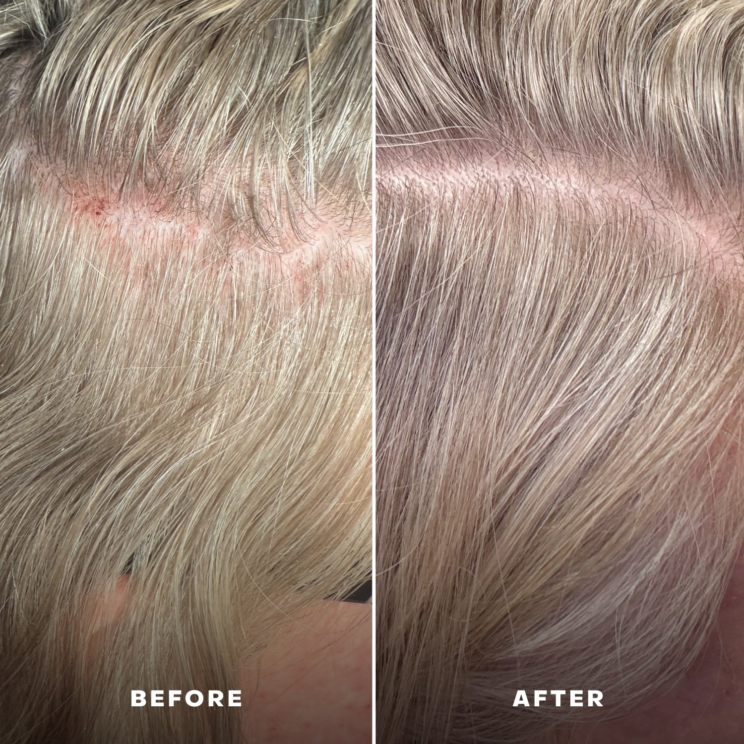 EverBoost™ Multi-Peptide Scalp Serum